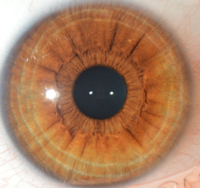 Lymphatic-iris-blue #1