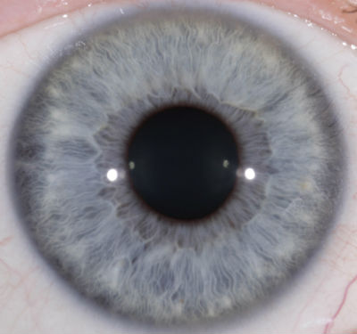 Lymphatic-iris-blue #1